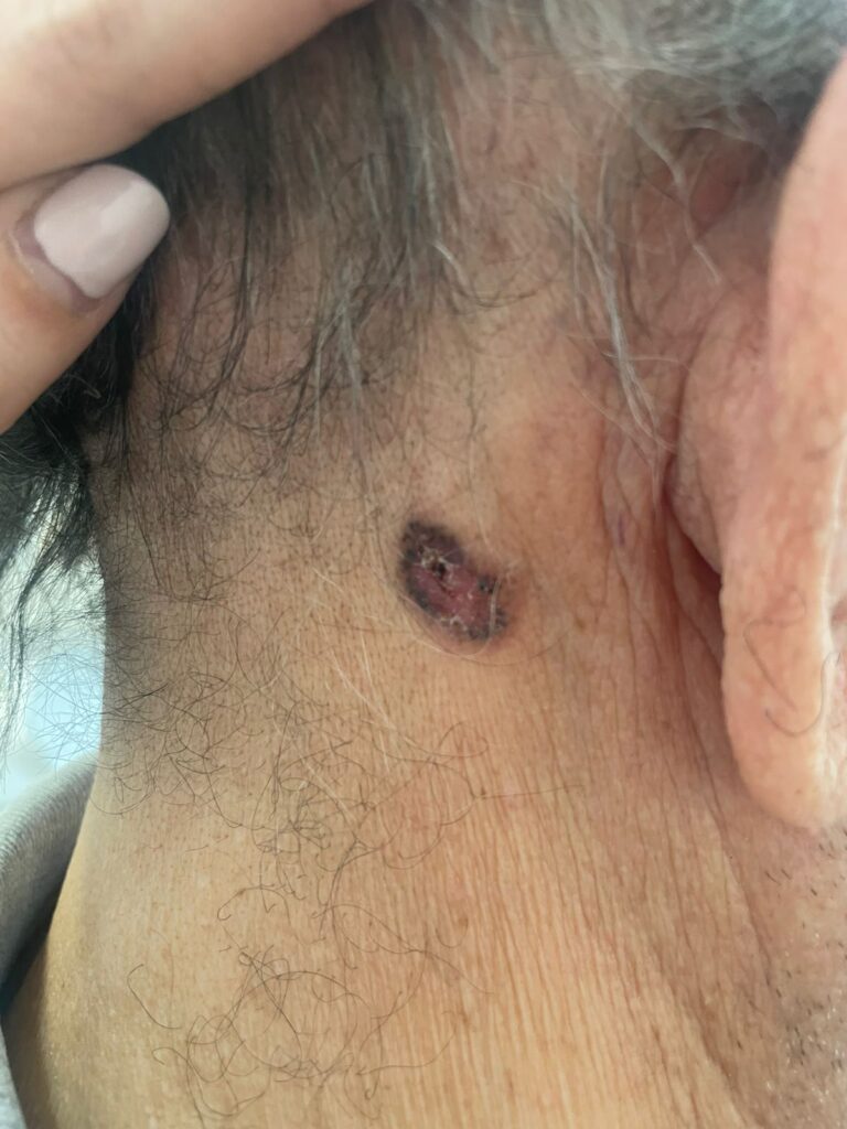 CBC de paciente en DermawWise clínica Dermatologica CDMX